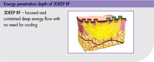 3DEEP® Technology